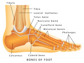 Broken Ankle Injuries