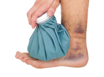 Sprained Ankle Treatment & Recovery