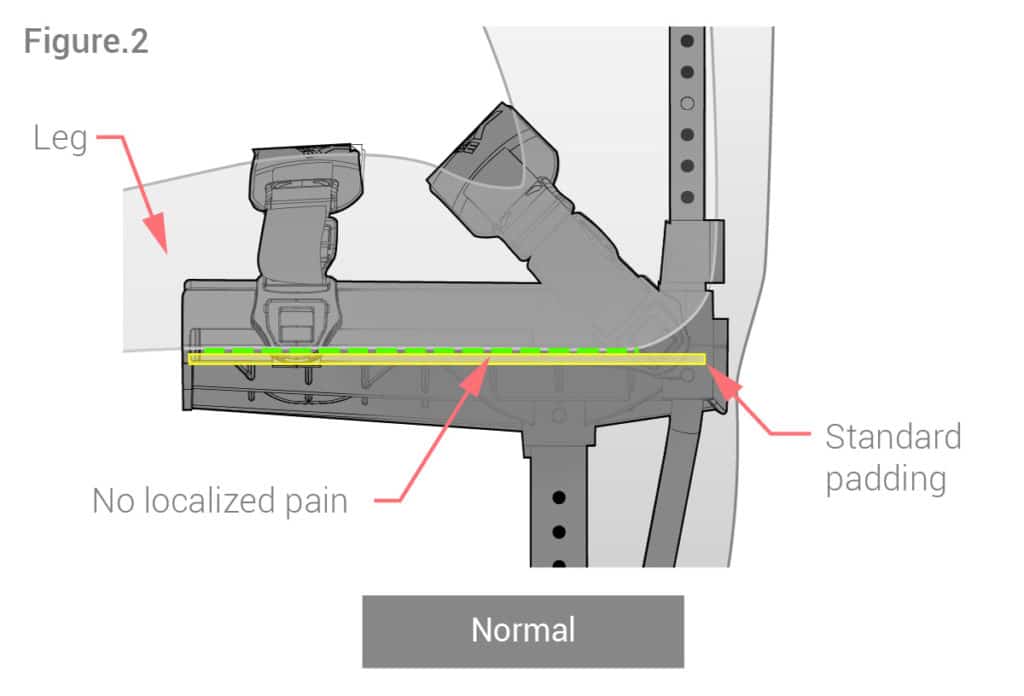 Leg on knee platform on iWALK Hands-Free Crutch graphic
