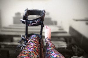 Foot Amputation Recovery Stretch for iWALK Hands-Free Crutch