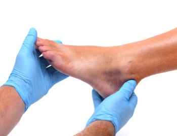 Weeks foot 4 broken walking after on Jones Fracture