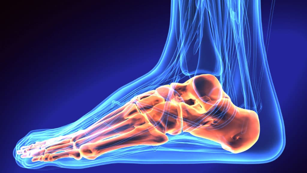 Avulsion Fracture of the Ankle: Symptoms, Causes, Treatment & Recovery