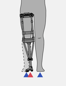 Make sure the angle of iWALK hands-free crutch is right for you - iWALKFree