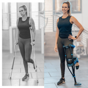 Crutches vs iWALK hands-free crutch iWALKFree