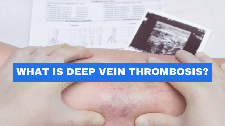 What is Deep Vein Thrombosis 1